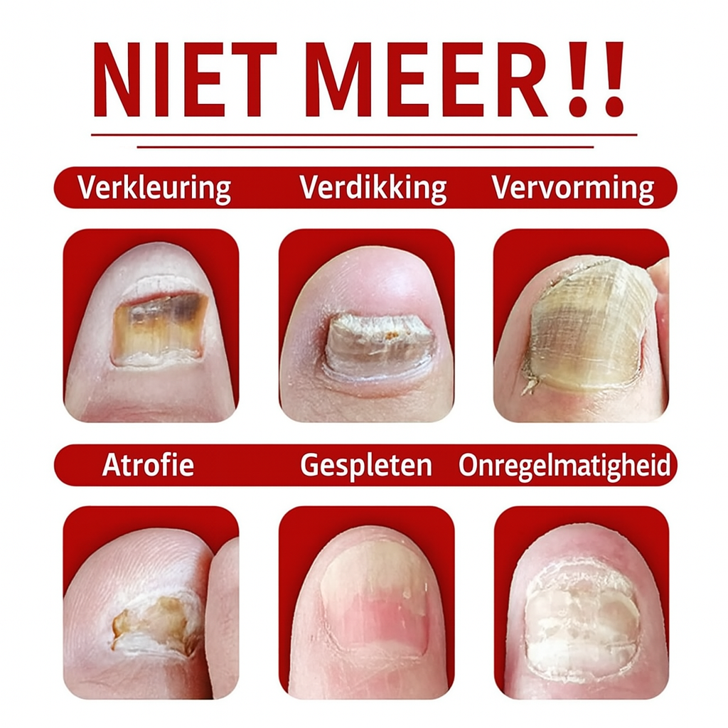 FungiFix™I Pakt Schimmels Snel En Doeltreffend Aan