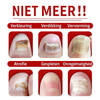 FungiFix™I Pakt Schimmels Snel En Doeltreffend Aan