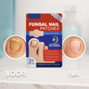 FungalNail™I Anti-Schimmel Teennagel Pleister