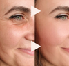 YouthPulse™ I Anti-Rimpel – Direct Liftend Effect