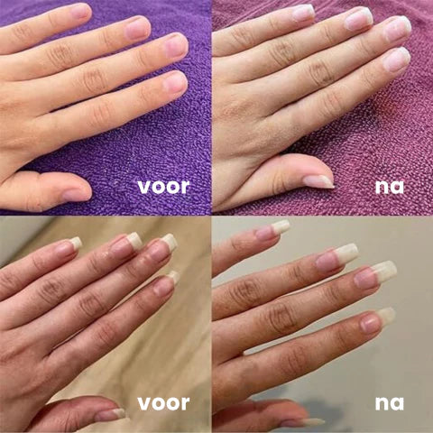 NailRepair™ I Herstelolie voor Snelle Nagelgroei