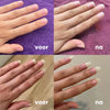 NailRepair™ I Herstelolie voor Snelle Nagelgroei