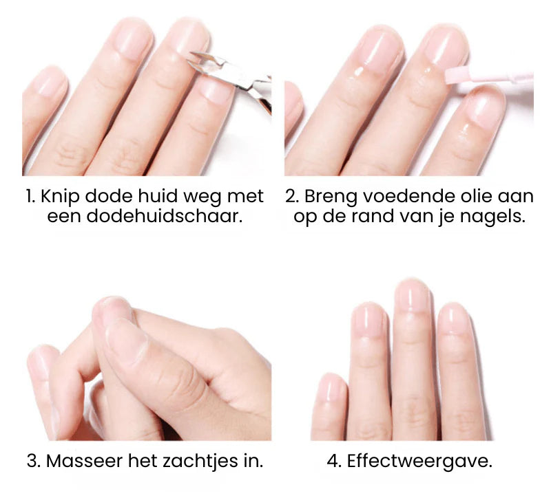 NailRepair™ I Herstelolie voor Snelle Nagelgroei