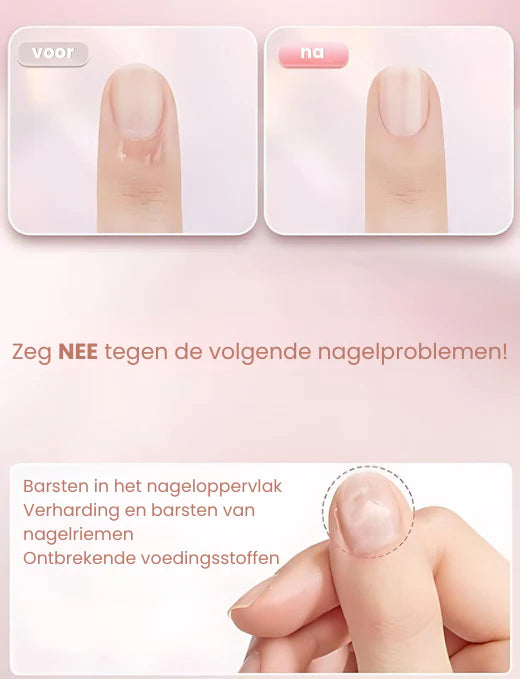NailRepair™ I Herstelolie voor Snelle Nagelgroei